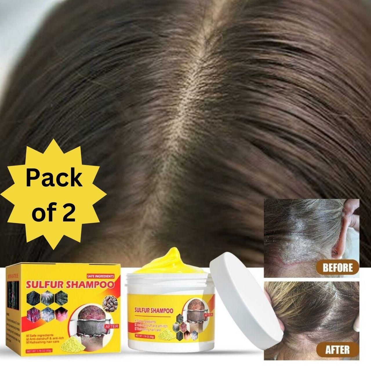 Shampoo Improve Dandruff Hair Breakage Hair (Pack Of 2)