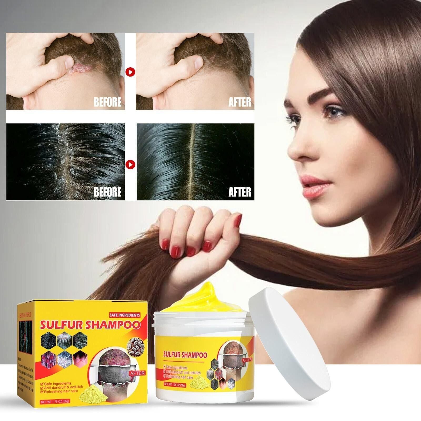 Shampoo Improve Dandruff Hair Breakage Hair (Pack Of 2)